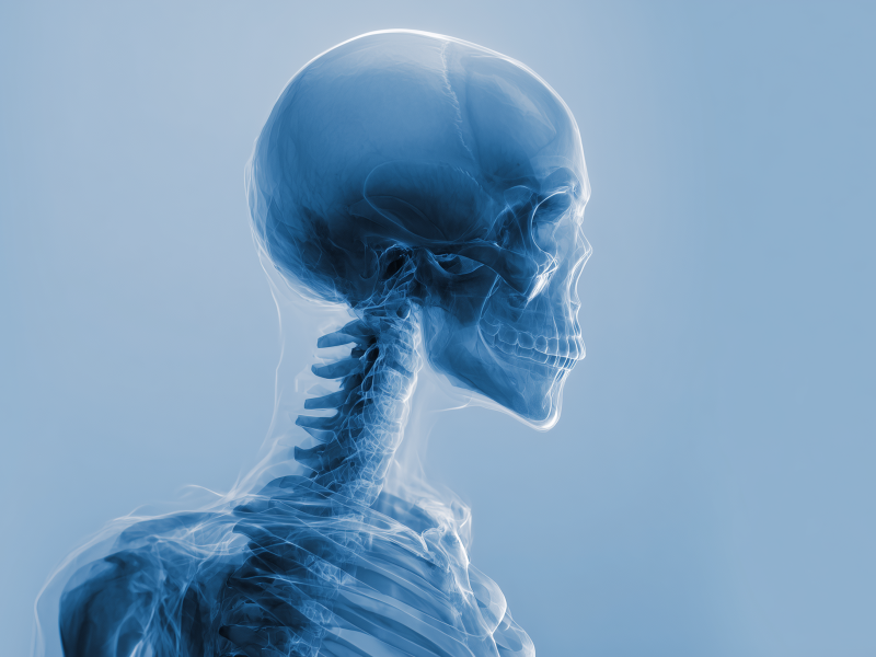 260120_CERTANIA_Spineserv_AI_HumanSkeletonXRay 260120_CERTANIA_Spineserv_AI_HumanSkeletonXRay